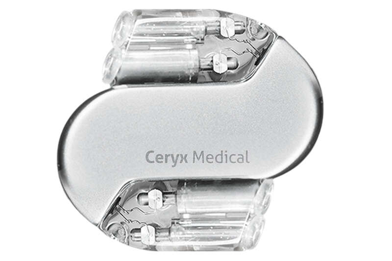 Ceryx Medical's bioelectronic technology