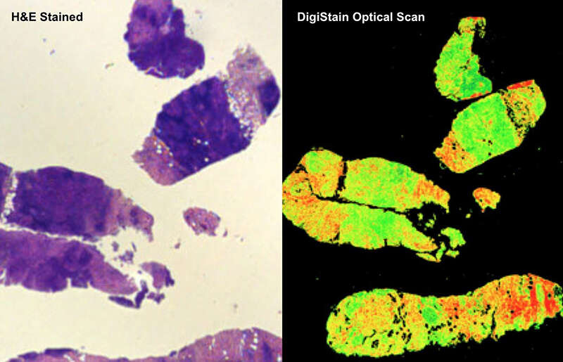 Digistain's biomedical implementation of infrared vibrational spectroscopy